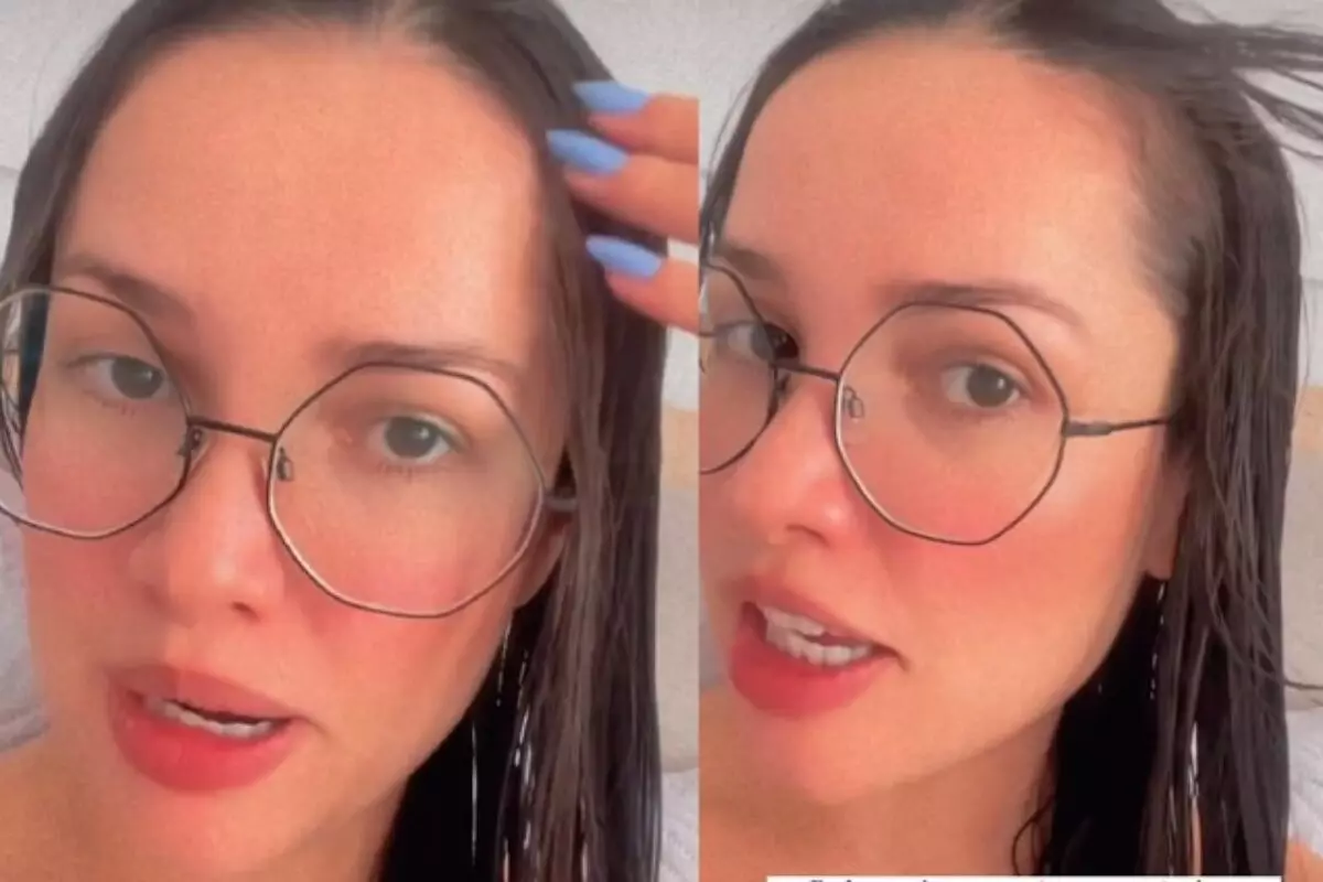 A cantora e influenciadora Juliette Freire, vencedora do Big Brother Brasil 21, surpreendeu seus fãs ao revelar que enfrenta calvície feminina desde a infância. Em entrevista recente, Juliette contou que sofre com falhas no couro cabeludo e está realizando tratamentos capilares específicos para estimular o crescimento dos fios nas áreas afetadas.